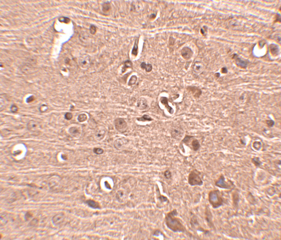 GLE1 Antibody in Immunohistochemistry (IHC)