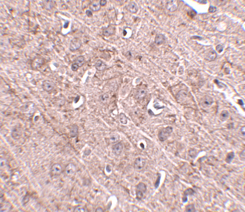 GLE1 Antibody in Immunohistochemistry (IHC)