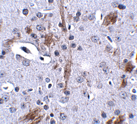 TTBK1 Antibody in Immunohistochemistry (IHC)