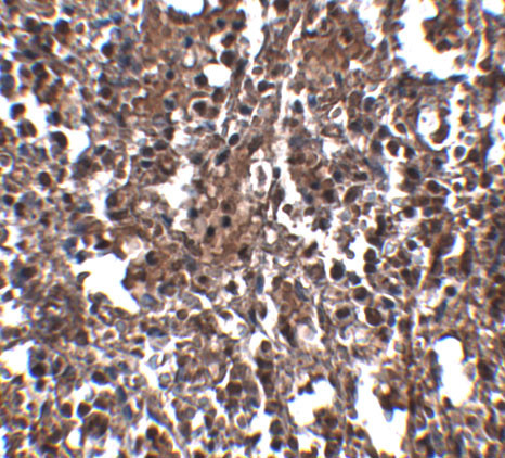 KLRA2 Antibody in Immunohistochemistry (IHC)
