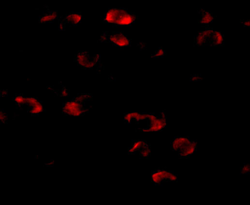 TMEM18 Antibody in Immunocytochemistry (ICC/IF)