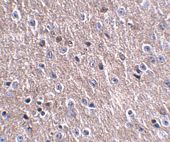 CDIP1 Antibody in Immunohistochemistry (IHC)