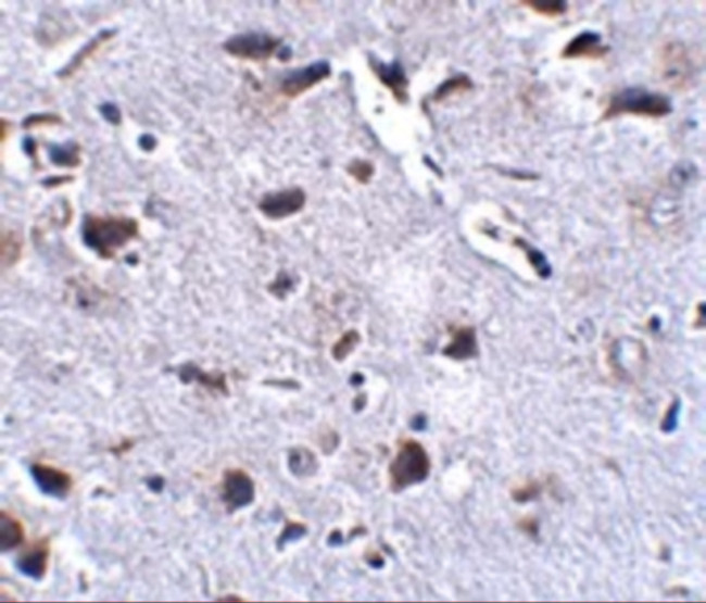 RCAN2 Antibody in Immunohistochemistry (IHC)