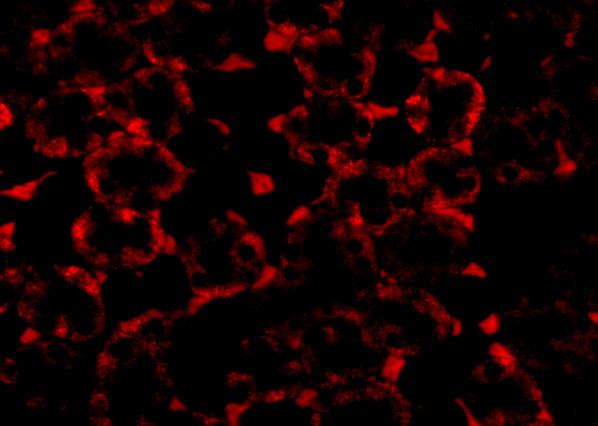 MTCH2 Antibody in Immunocytochemistry (ICC/IF)