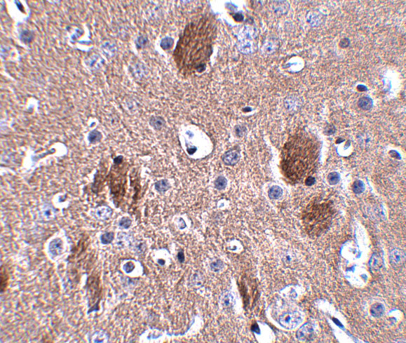 CDIP1 Antibody in Immunohistochemistry (IHC)