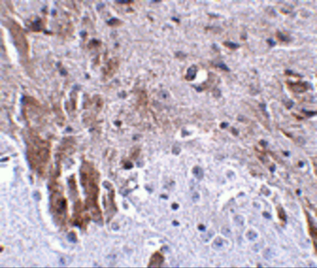 LRFN1 Antibody in Immunohistochemistry (IHC)