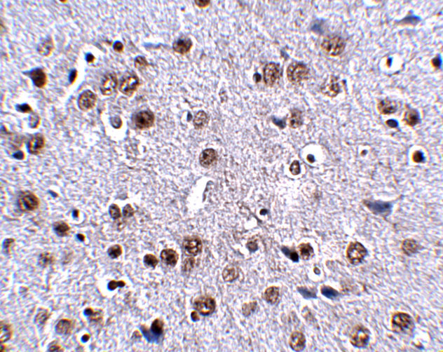 LRFN4 Antibody in Immunohistochemistry (IHC)