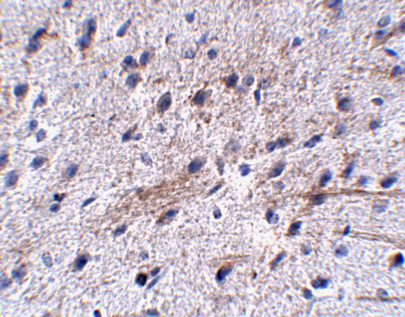 LRFN5 Antibody in Immunohistochemistry (IHC)