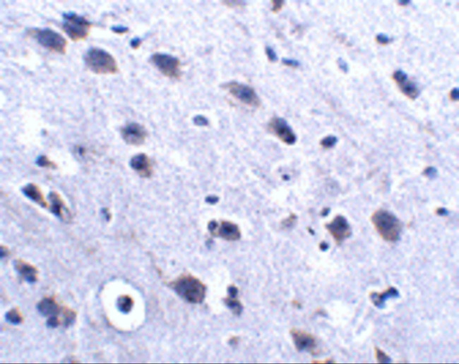LRFN2 Antibody in Immunohistochemistry (IHC)