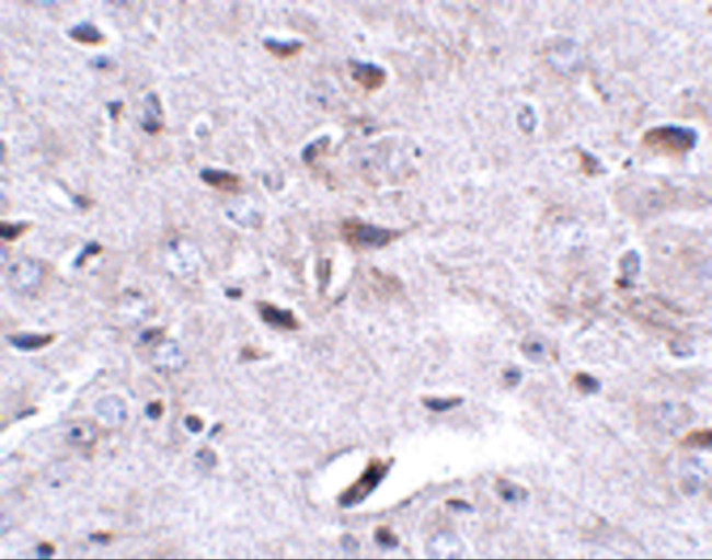 LRFN3 Antibody in Immunohistochemistry (IHC)