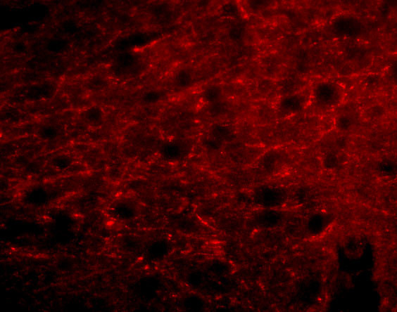 Bora Antibody in Immunocytochemistry (ICC/IF)