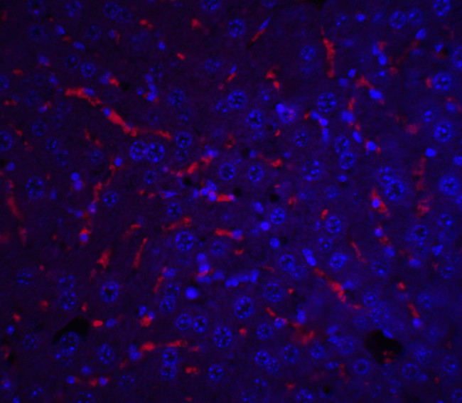 ApoA1 Antibody in Immunohistochemistry (IHC)