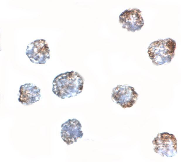 MATN3 Antibody in Immunocytochemistry (ICC/IF)