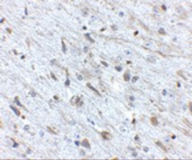 FKBP15 Antibody in Immunohistochemistry (IHC)