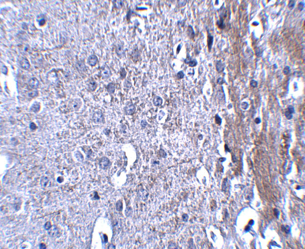 MATN4 Antibody in Immunohistochemistry (IHC)
