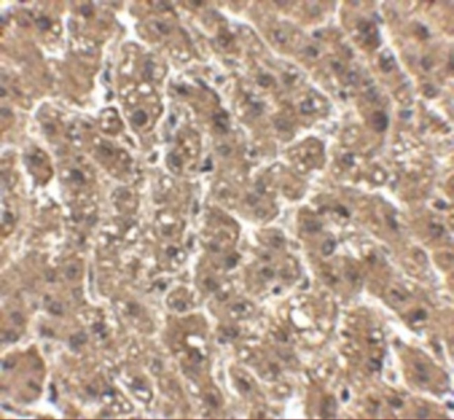 ErbB2 (HER-2) Antibody in Immunohistochemistry (IHC)