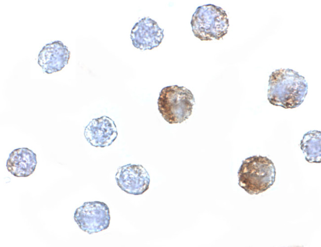 ST3GAL6 Antibody in Immunocytochemistry (ICC/IF)