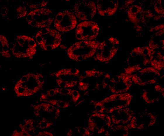 NPC1 Antibody in Immunocytochemistry (ICC/IF)