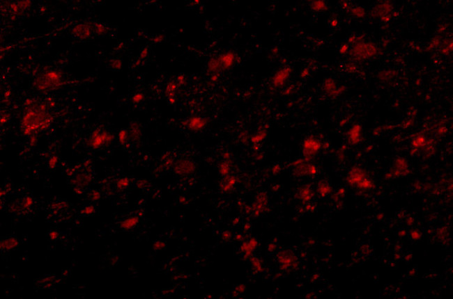 MC4R Antibody in Immunocytochemistry (ICC/IF)