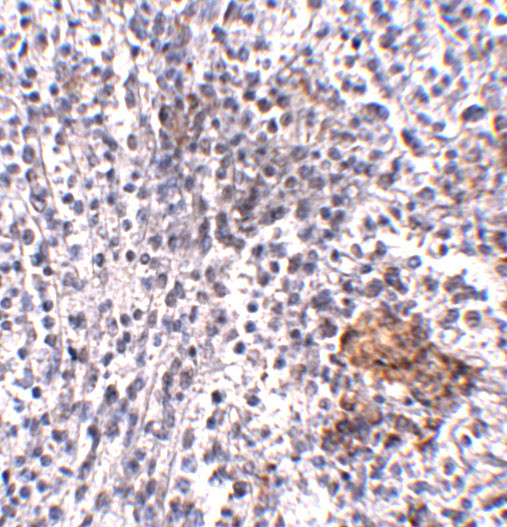 SHOC2 Antibody in Immunohistochemistry (IHC)