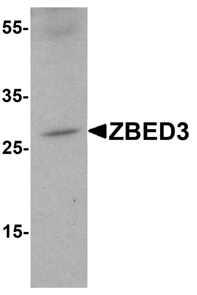 ZBED3 Antibody in Western Blot (WB)