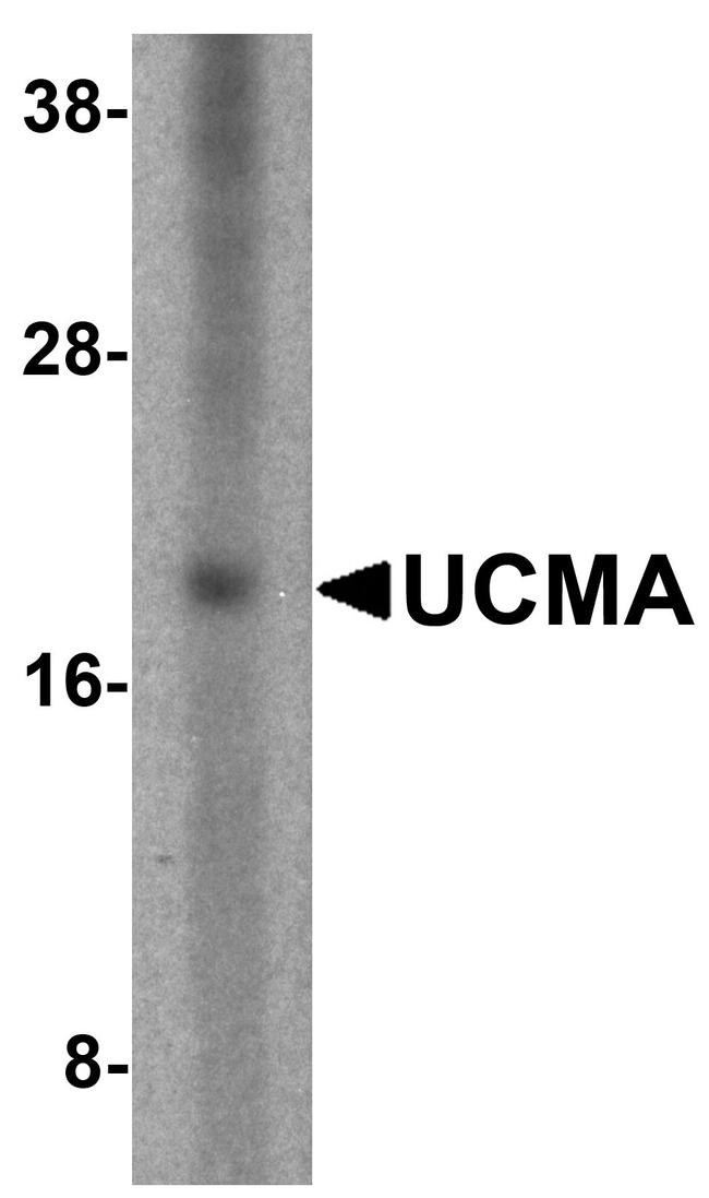 UCMA Antibody in Western Blot (WB)