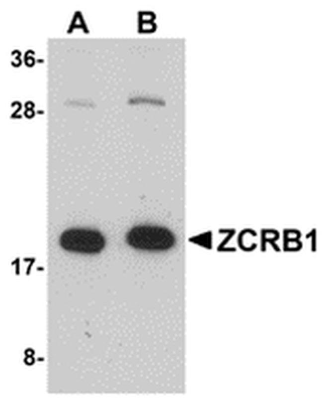 ZCRB1 Antibody in Western Blot (WB)
