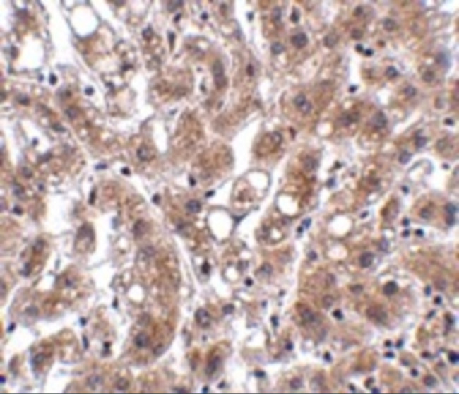 THEM4 Antibody in Immunohistochemistry (IHC)