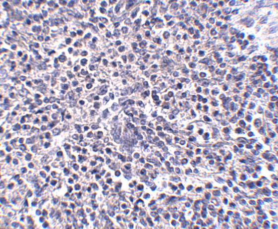 ARL15 Antibody in Immunohistochemistry (IHC)