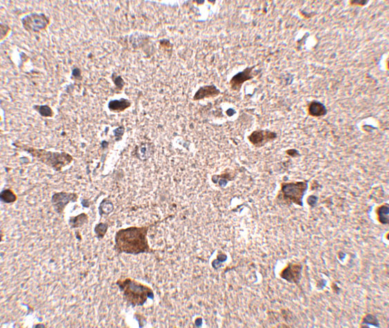CCDC134 Antibody in Immunohistochemistry (IHC)