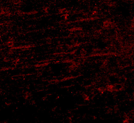 SCAMP4 Antibody in Immunocytochemistry (ICC/IF)