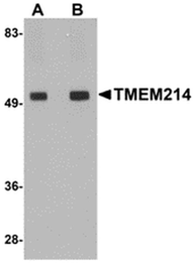 TMEM214 Antibody in Western Blot (WB)