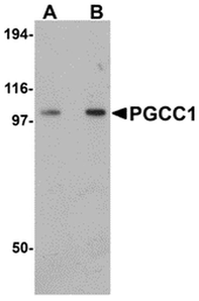 FAM120B Antibody in Western Blot (WB)