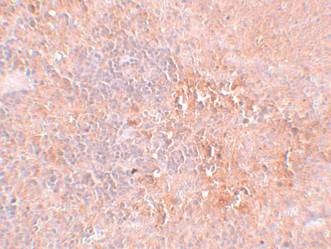 JMJD4 Antibody in Immunohistochemistry (IHC)