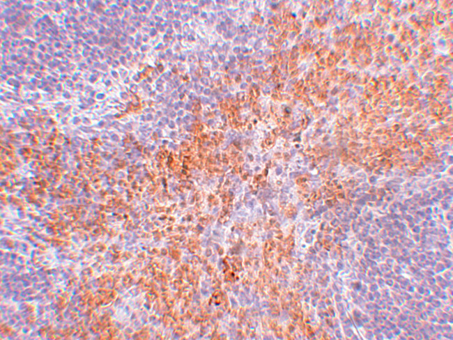 RIP1 Antibody in Immunohistochemistry (IHC)