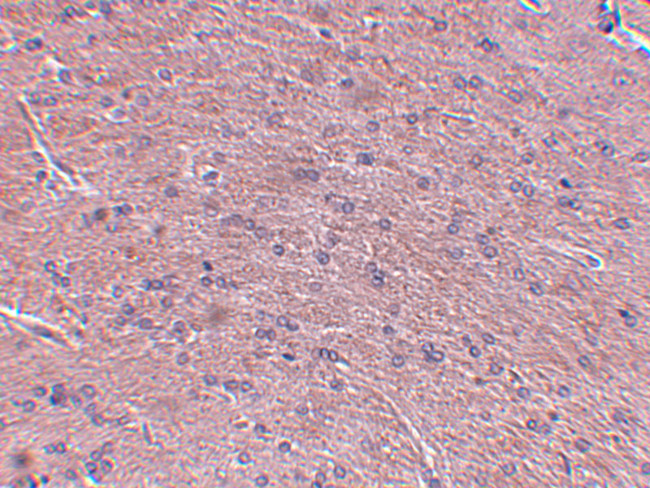 Prosapip1 Antibody in Immunohistochemistry (IHC)