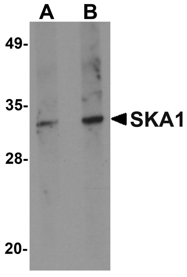 SKA1 Antibody in Western Blot (WB)