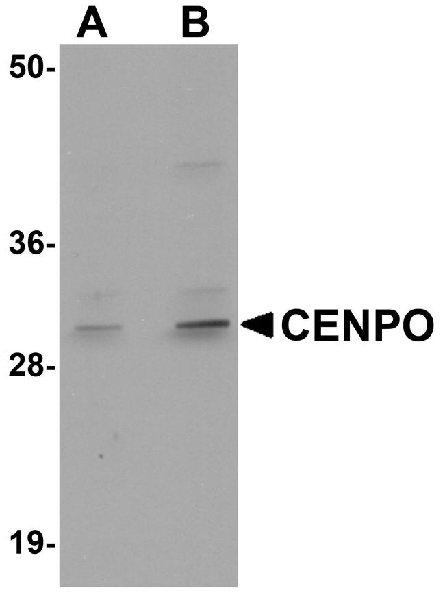CENPO Antibody in Western Blot (WB)