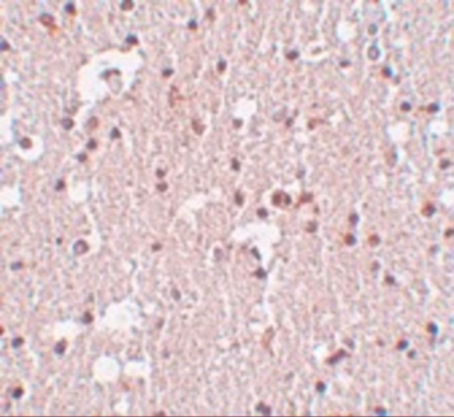 FRMPD3 Antibody in Immunohistochemistry (IHC)