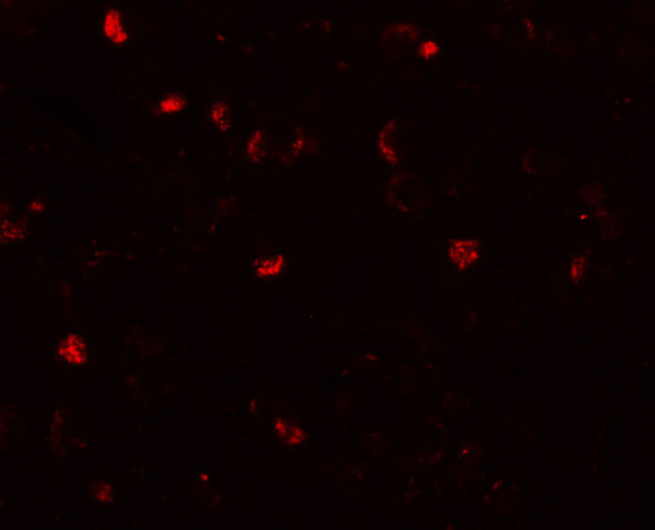 TMEM16B Antibody in Immunocytochemistry (ICC/IF)
