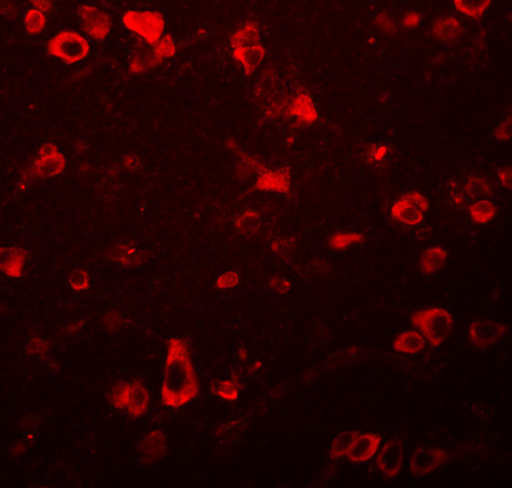 FAM59B Antibody in Immunocytochemistry (ICC/IF)