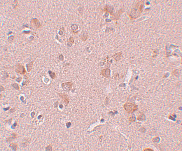 PLEKHM3 Antibody in Immunohistochemistry (IHC)