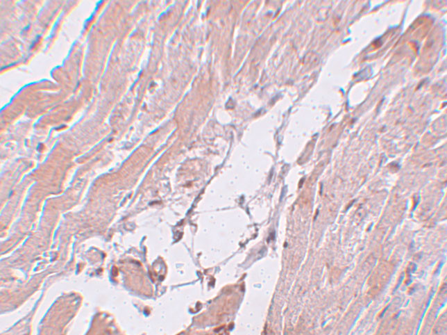 CCDC47 Antibody in Immunohistochemistry (IHC)