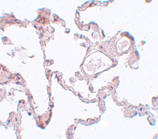 PLEKHM1 Antibody in Immunohistochemistry (IHC)