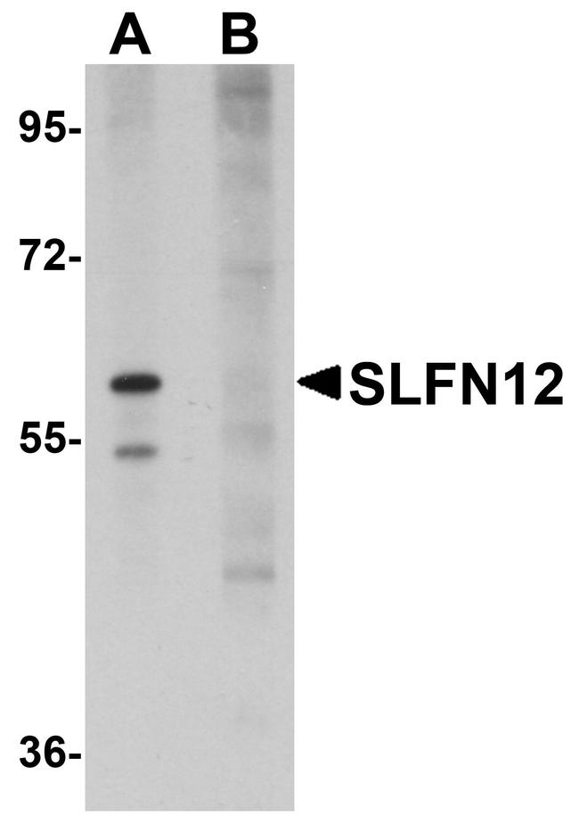 SLFN12 Antibody in Western Blot (WB)
