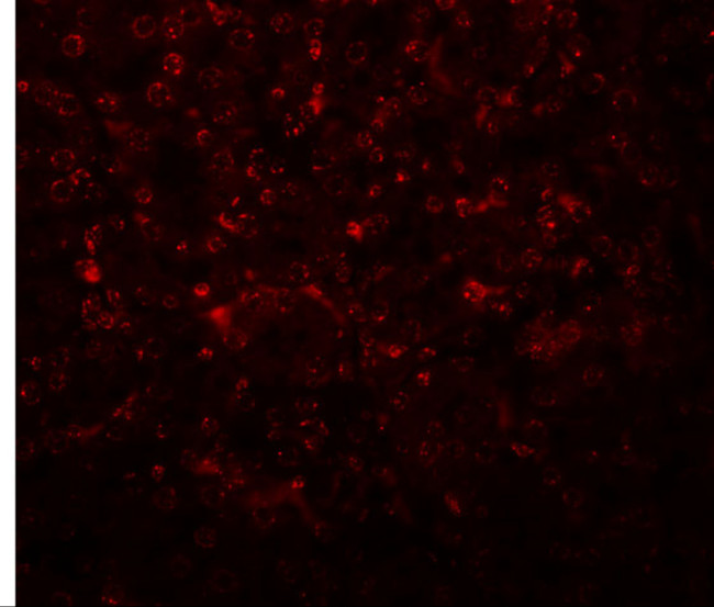 SLFN14 Antibody in Immunohistochemistry (IHC)