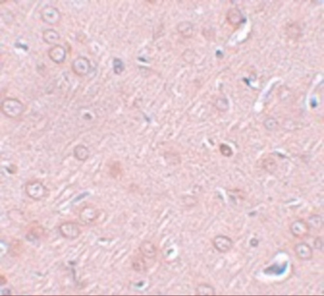 SYNGR2 Antibody in Immunohistochemistry (IHC)