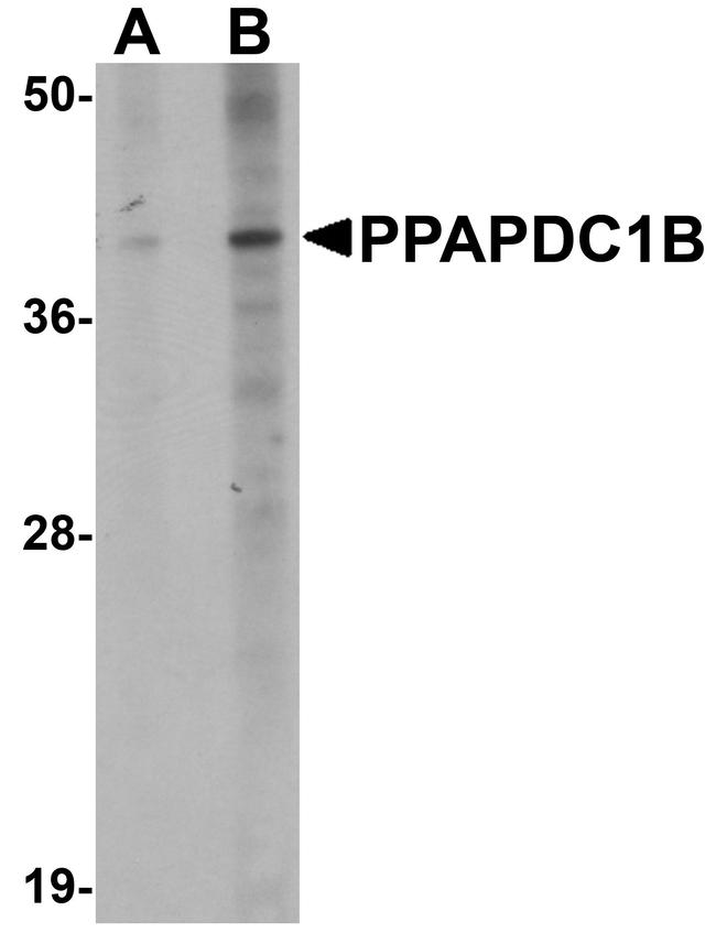 PPAPDC1B Antibody in Western Blot (WB)