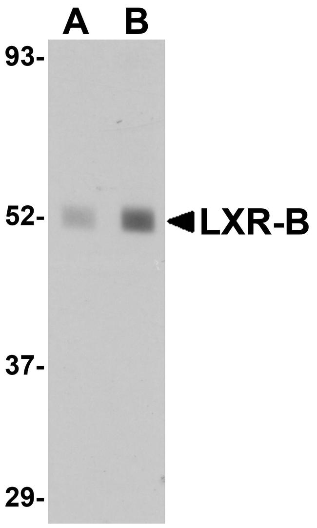 LXR beta Antibody in Western Blot (WB)