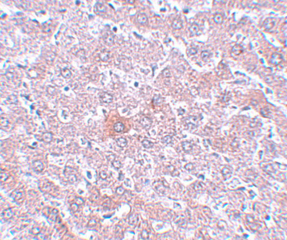 RSRC1 Antibody in Immunohistochemistry (IHC)